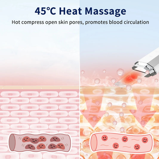 Advanced Ultrasonic Skin Scrubber for Deep Facial Cleaning and Lifting