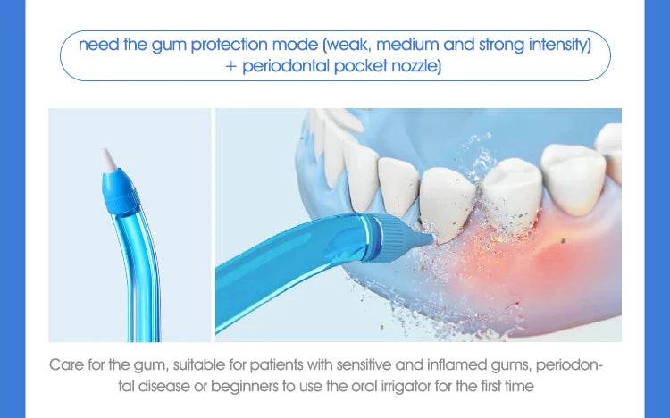 Pro Water Flosser – Advanced Oral Irrigator for Superior Teeth Cleaning - My Store