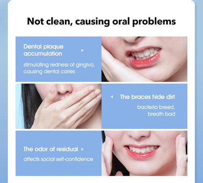 Pro Water Flosser – Advanced Oral Irrigator for Superior Teeth Cleaning - My Store