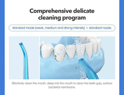 Pro Water Flosser – Advanced Oral Irrigator for Superior Teeth Cleaning - My Store