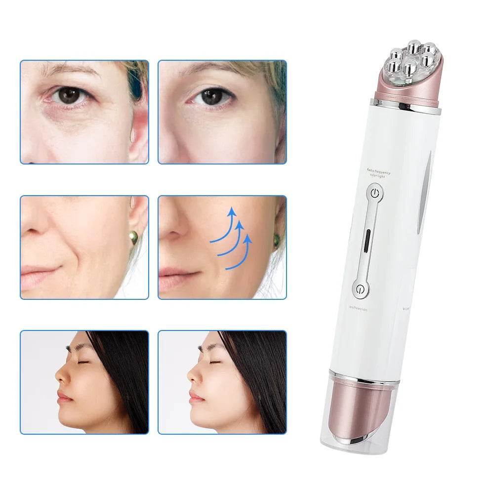 Advanced Mini EMS Eye Massager for Skin Rejuvenation and Anti-Wrinkle Care - My Store