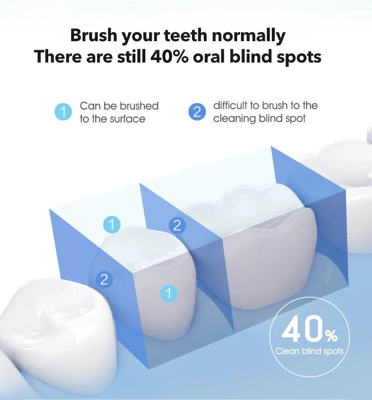 Pro Water Flosser – Advanced Oral Irrigator for Superior Teeth Cleaning - My Store