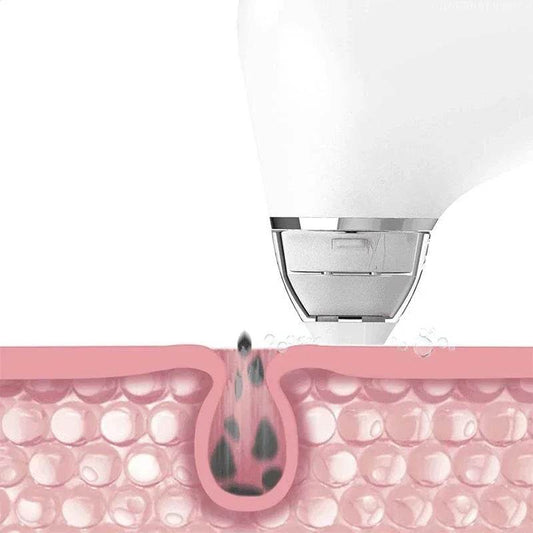 Xiaomi DOCO Ultra-Micro Bubble Pore Vacuum Cleaner – Electric Acne and Blackhead Remover - My Store
