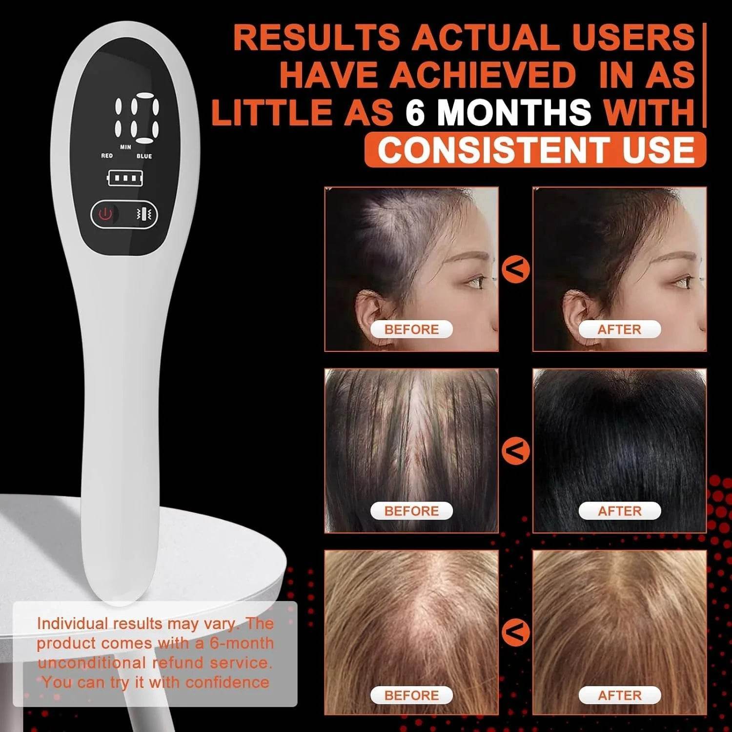 Infrared Laser Hair Therapy Comb with massage -Promotes Hair Growth - My Store